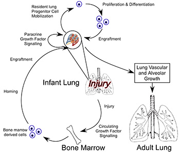 Stem and Progenitor Cells in Neonatal Lung Injury and Repair